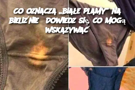 Co oznacza „białe plamy” na bieliźnie? Dowiedz się, co mogą wskazywać