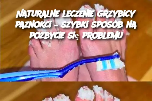 Naturalne leczenie grzybicy paznokci – szybki sposób na pozbycie się problemu