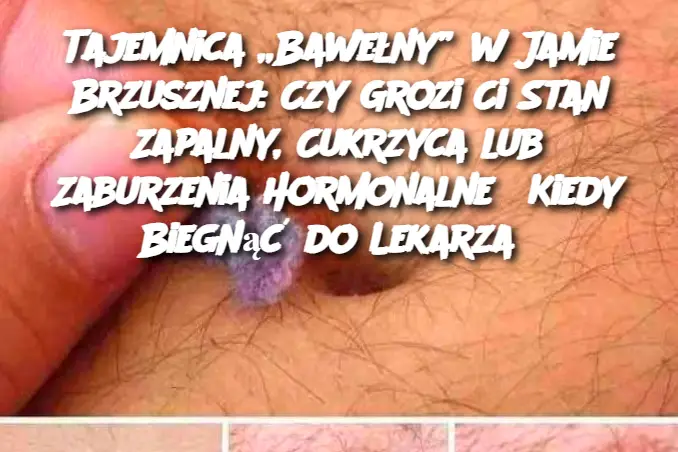 Tajemnica „Bawełny” w Jamie Brzusznej: Czy Grozi Ci Stan Zapalny, Cukrzyca lub Zaburzenia Hormonalne? Kiedy Biegnąć do Lekarza?