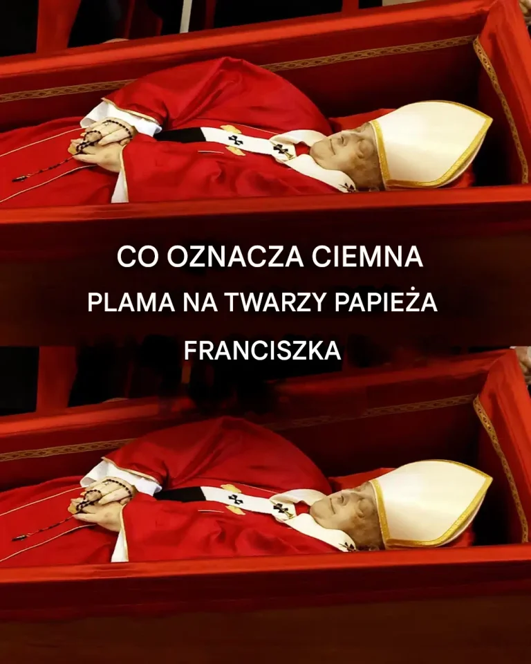 Quelle est cette tache sombre visible sur le visage du Pape François : les hypothèses des experts