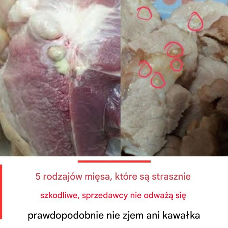 Uwaga na talerzu: 5 rodzajów mięsa, które mogą zaszkodzić Twojemu zdrowiu