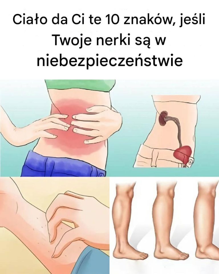 Nie ignoruj tych sygnałów: 10 objawów, które mogą świadczyć o chorobie nerek