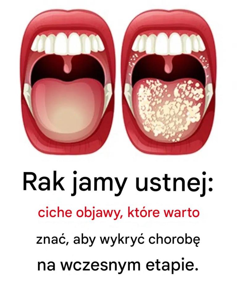 Cisza, która boli: najczęstsze sygnały ostrzegawcze raka jamy ustnej i jak je rozpoznać