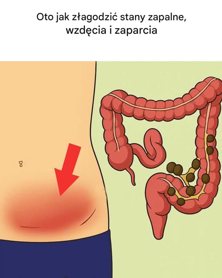 Mikstura na Trawienie: Naturalny Przepis na Wzdęcia, Zaparcia i Ukojenie Stanów Zapalnych