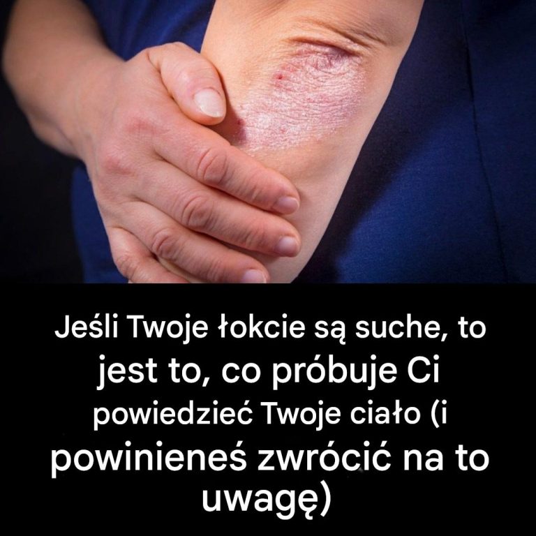Suche łokcie: typowy objaw czy ostrzeżenie przed czymś poważniejszym?