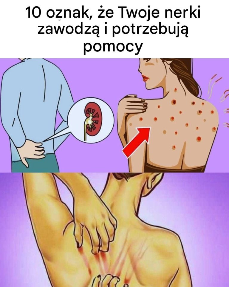 10 wyraźnych oznak problemów z nerkami