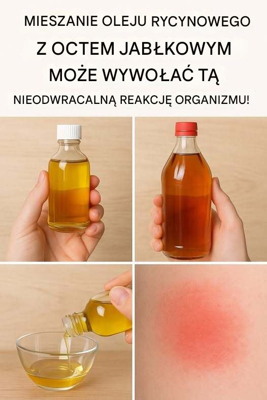 Niesamowite korzyści z mieszania oleju rycynowego z octem jabłkowym