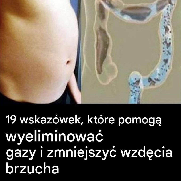 19 wskazówek, jak wyeliminować gazy i zmniejszyć wzdęcia brzucha