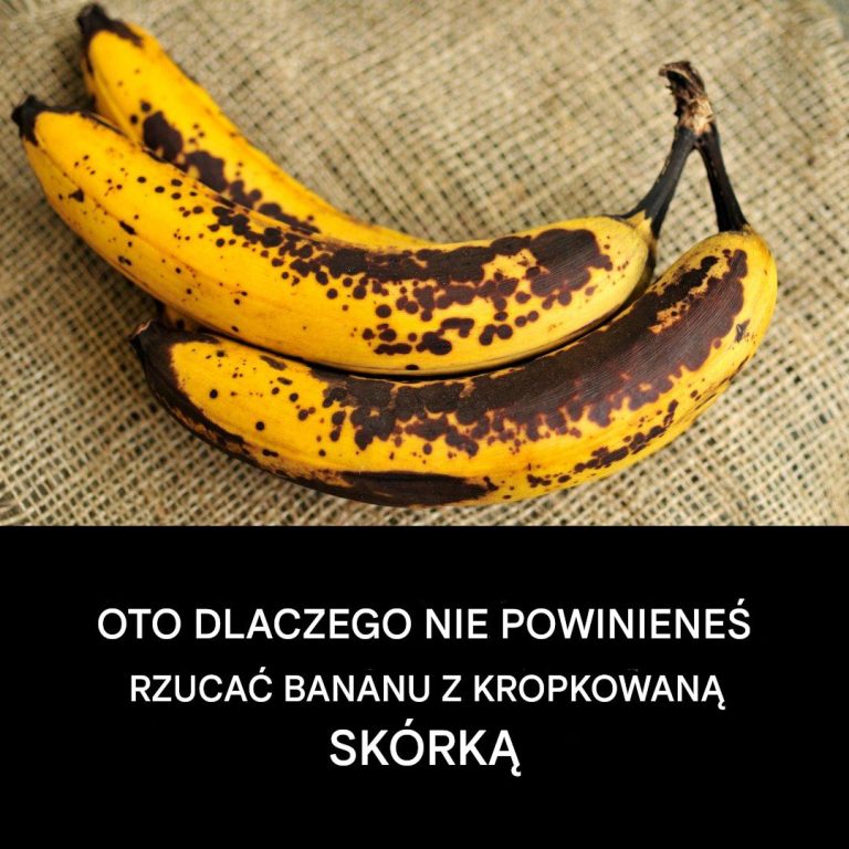 Oto dlaczego nie należy wyrzucać banana z plamkami na skórce