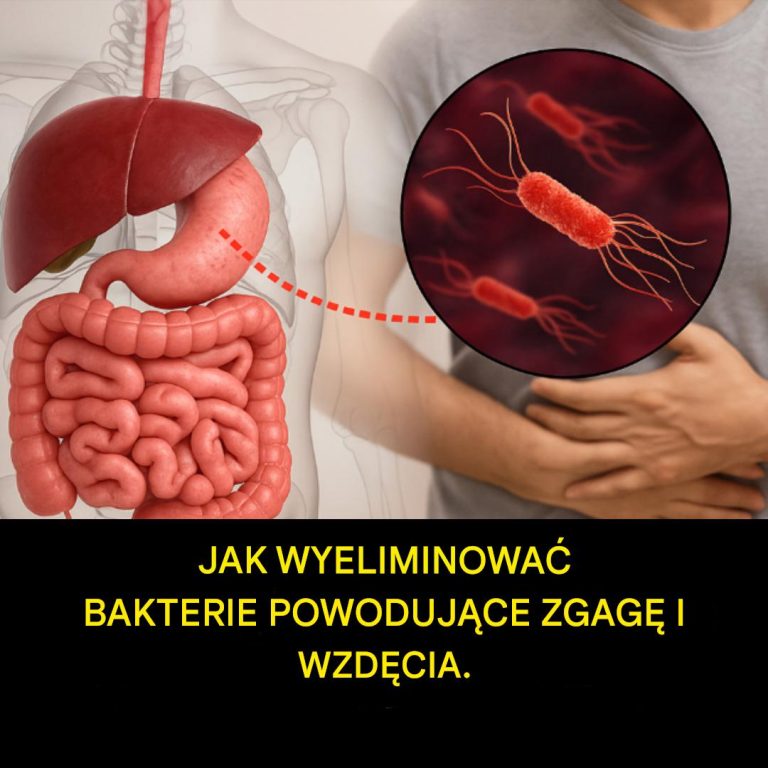 Jak leczyć H. Pylori (Helicobacter Pylori) w sposób naturalny