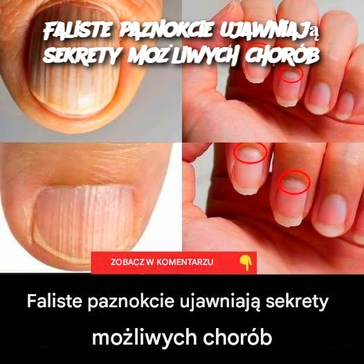 Faliste paznokcie ujawniają sekrety możliwych chorób