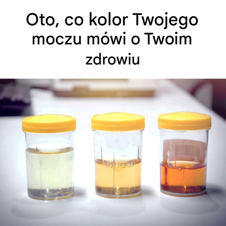 Co kolor moczu mówi o Twoim zdrowiu