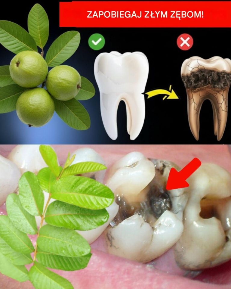 3 najlepsze sposoby leczenia próchnicy zębów liśćmi guawy – proste i niedrogie