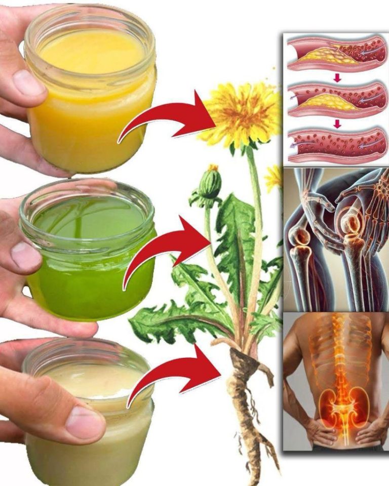 Mniszek Lekarski: 30 Zaskakujących Właściwości Tego Roślinnego Skarbu, Którego Nie Doceniasz