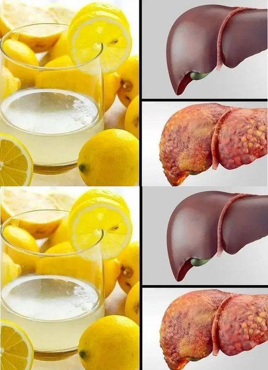 Przygotowanie Do blendera włóż ananasa, sok z cytryny i imbir, a następnie dokładnie zmiksuj. Dodaj wodę i wszystko dokładnie wymieszaj. Następnie przelej sok spalający tłuszcz do szklanki i ciesz się jego smakiem.