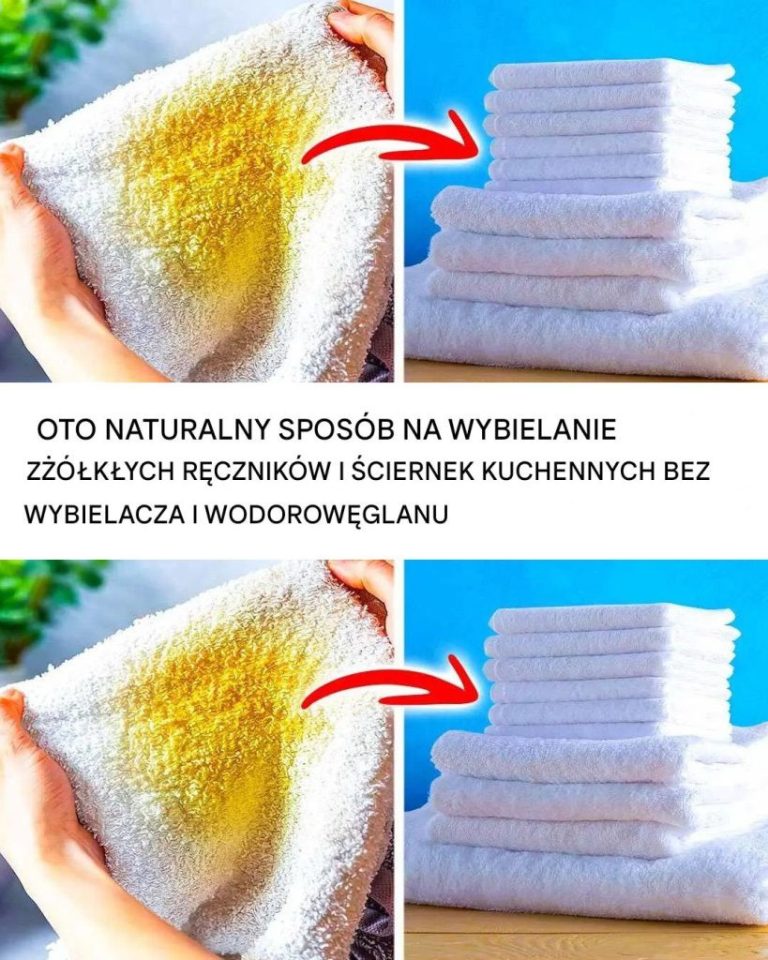 Zażółcone ściereczki i ręczniki: naturalne rozwiązanie bez wybielacza i wodorowęglanu