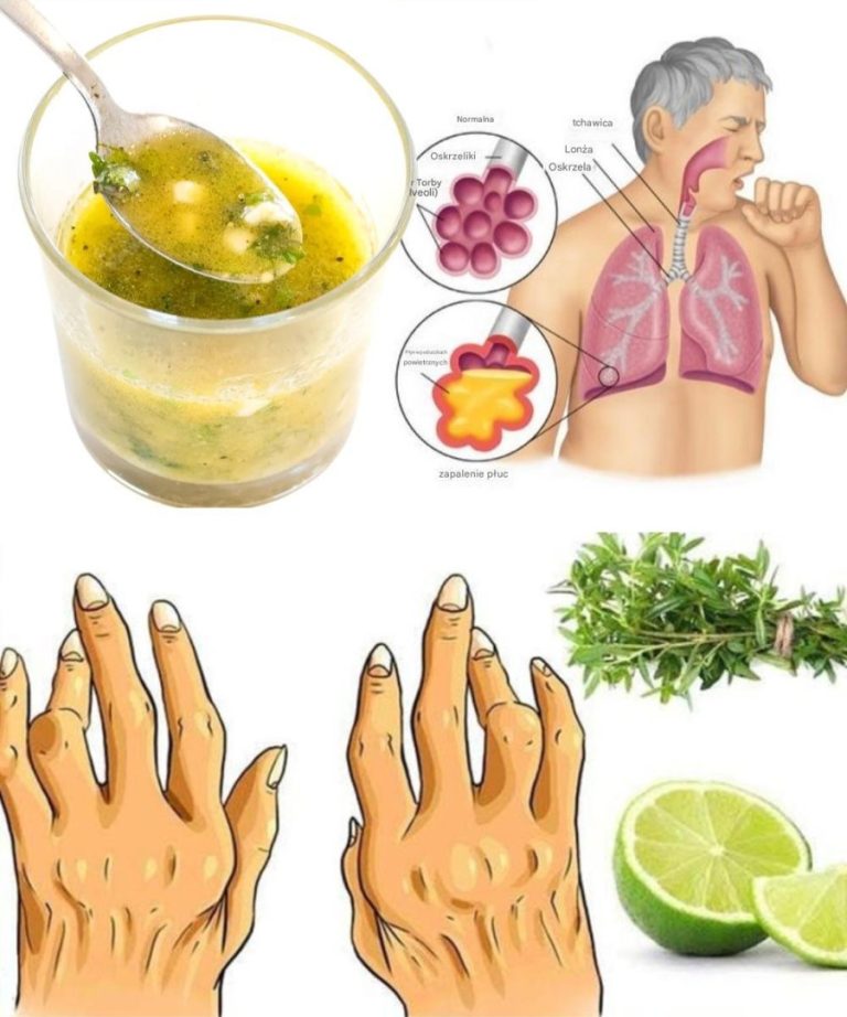 Tymianek i cytryna: naturalny środek na artretyzm i stany zapalne