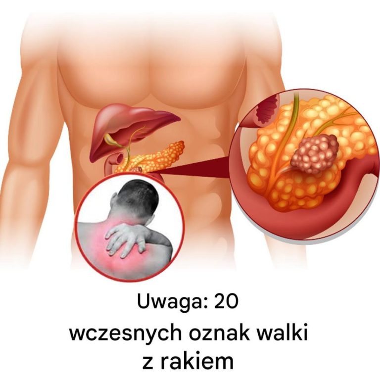 20 wczesnych oznak, że Twój organizm walczy z chorobą