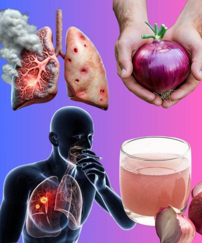 Uporczywy kaszel, flegma lub zatkany nos? Wypróbuj ten naturalny środek z cebulą.