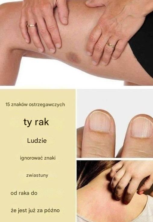 15 ostrzegawczych objawów raka, które ludzie ignorują, dopóki nie jest za późno