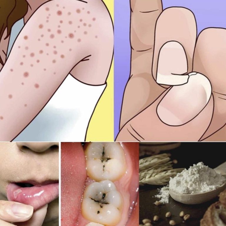 9 oznak nietolerancji glutenu, które każdy powinien znać