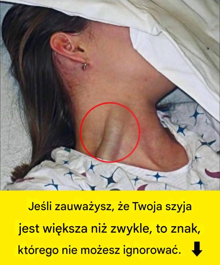 Jeśli zauważysz, że Twoja szyja jest większa niż zwykle, to znak, którego nie możesz ignorować.