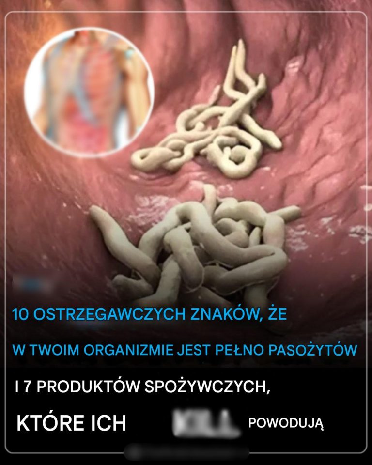 10 ostrzegawczych znaków, że w Twoim organizmie znajduje się mnóstwo pasożytów i 7 produktów spożywczych, które pomogą się ich pozbyć!