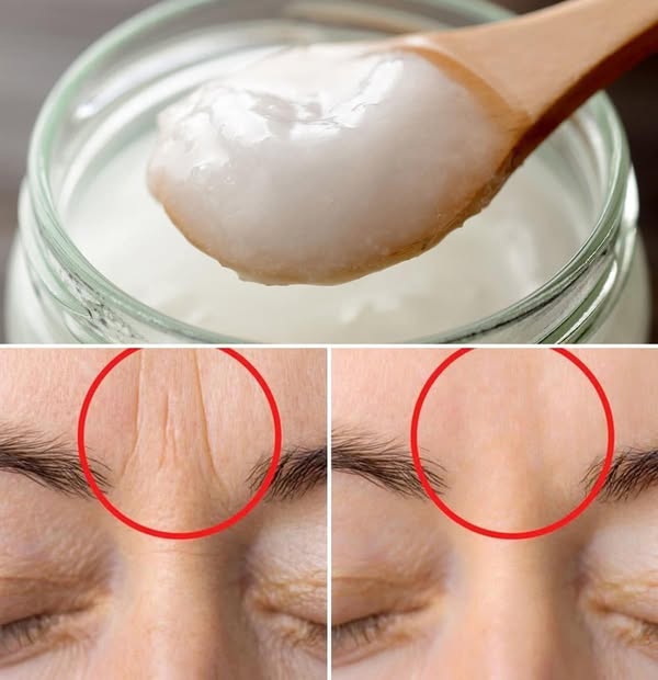 2 masks to get rid of wrinkles on the forehead