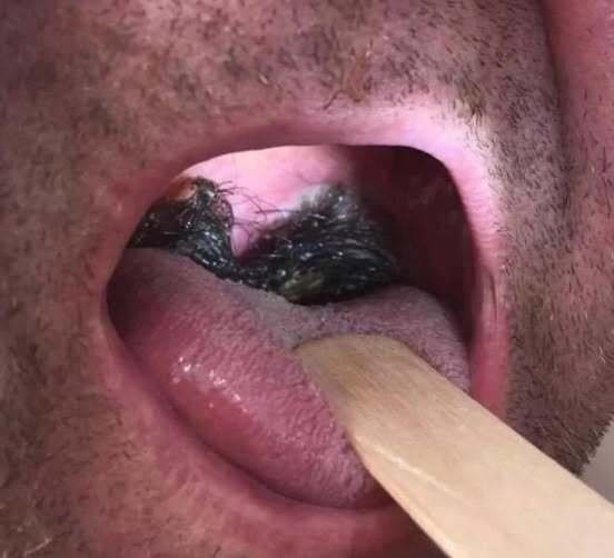 Oto konsekwencje spania z... W dzisiejszej erze intymnej swobody i zmieniającej się dynamiki związków, rozmowy o zdrowiu intymnym są ważniejsze niż kiedykolwiek.