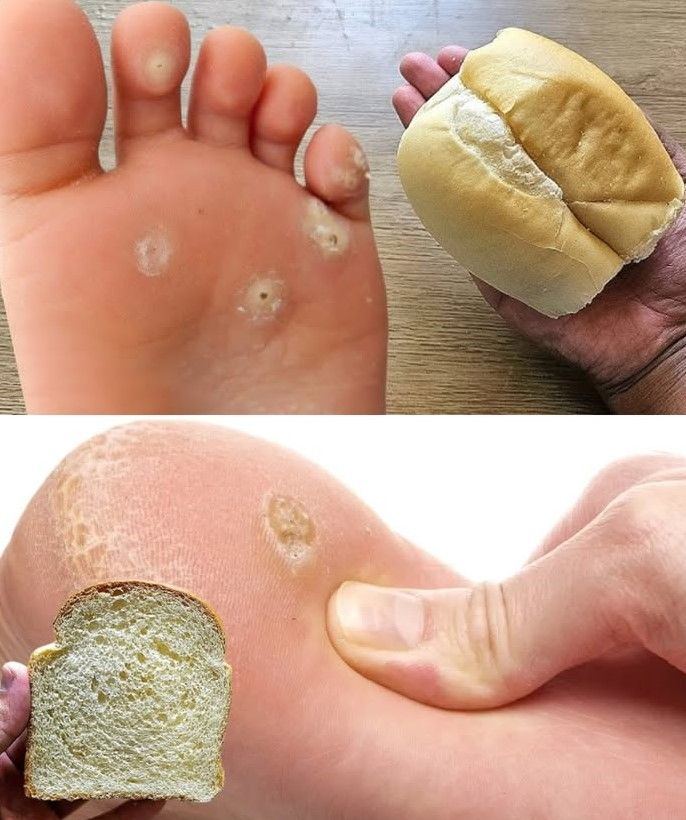 Usuń odciski ze stóp w naturalny sposób dzięki temu prostemu sposobowi na bazie chleba