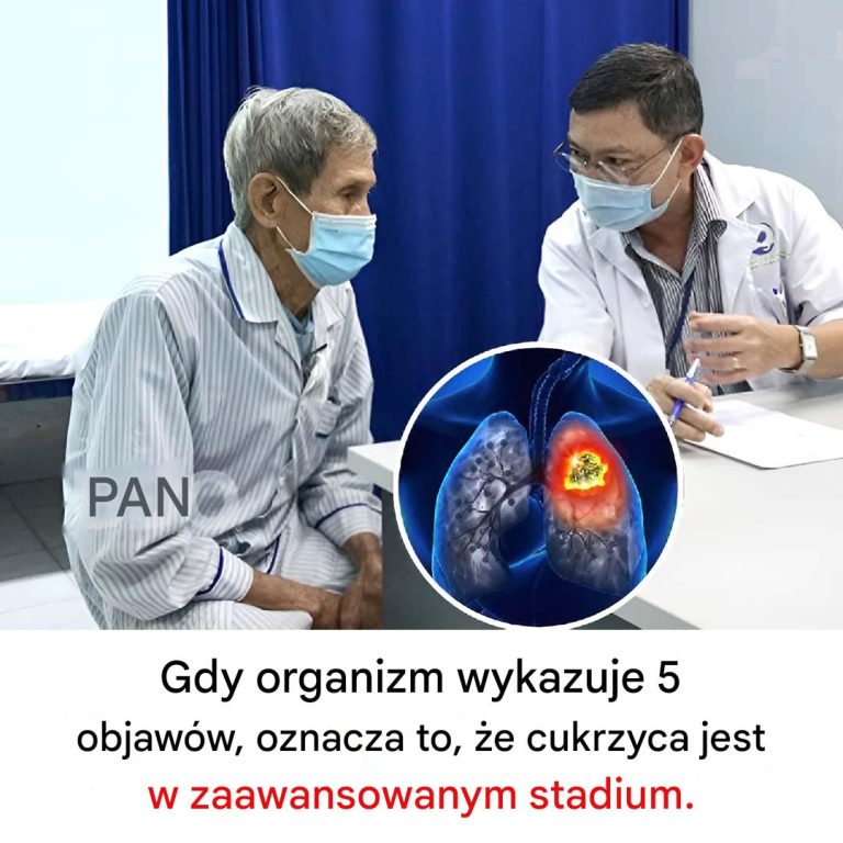 Kiedy organizm wykazuje 5 objawów, oznacza to, że cukrzyca jest w zaawansowanym stadium
