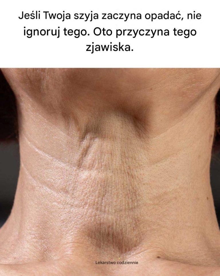 Jeśli Twoja szyja zaczyna zwisać, nie ignoruj ​​tego. Oto dlaczego tak się dzieje.