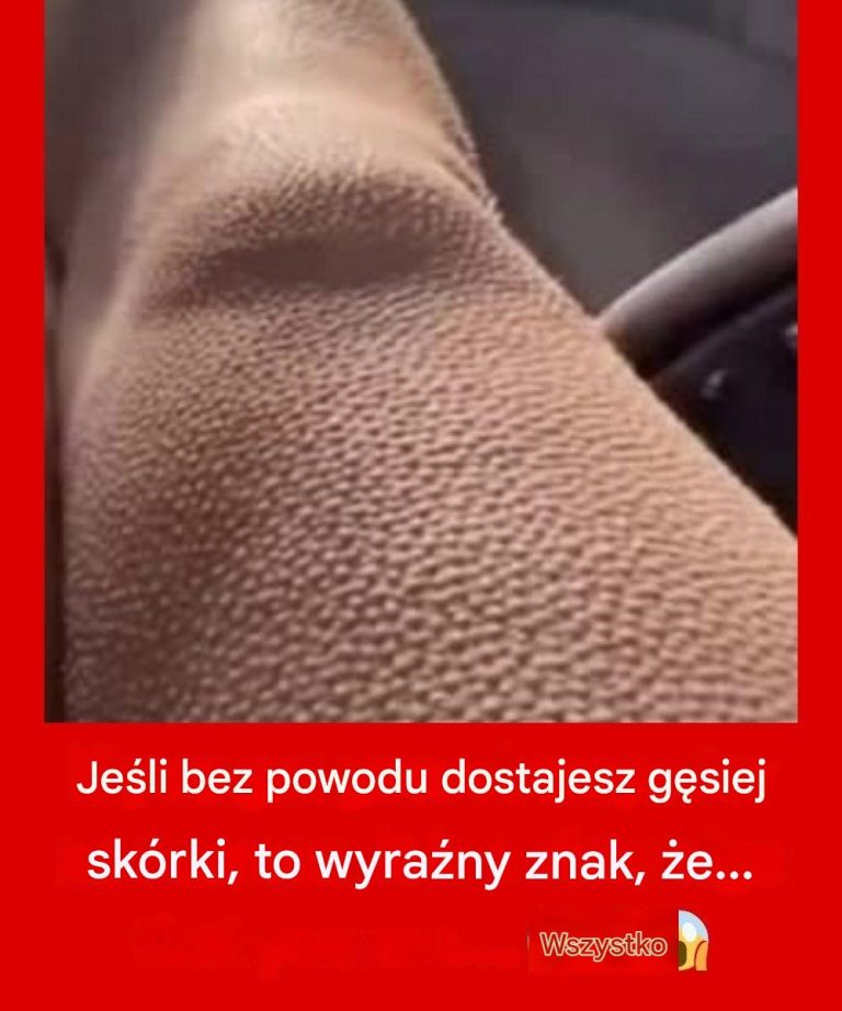 Jeśli bez powodu dostajesz gęsiej skórki, to wyraźny znak, że...