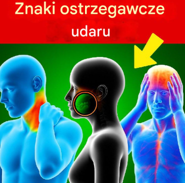 7 objawów udaru mózgu – co musisz wiedzieć!