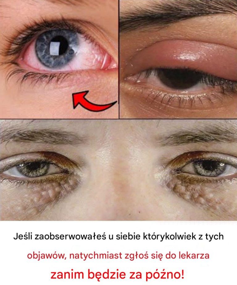 8 rzeczy, które Twoje oczy mówią o Twoim zdrowiu! Jeśli masz którykolwiek z tych objawów, natychmiast udaj się do lekarza!