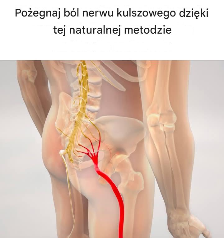Pożegnaj ból nerwu kulszowego dzięki tej naturalnej metodzie