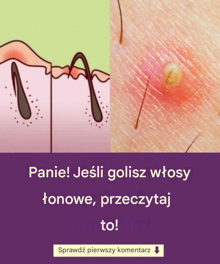 Panie! Jeśli golisz włosy łonowe, przeczytaj to!