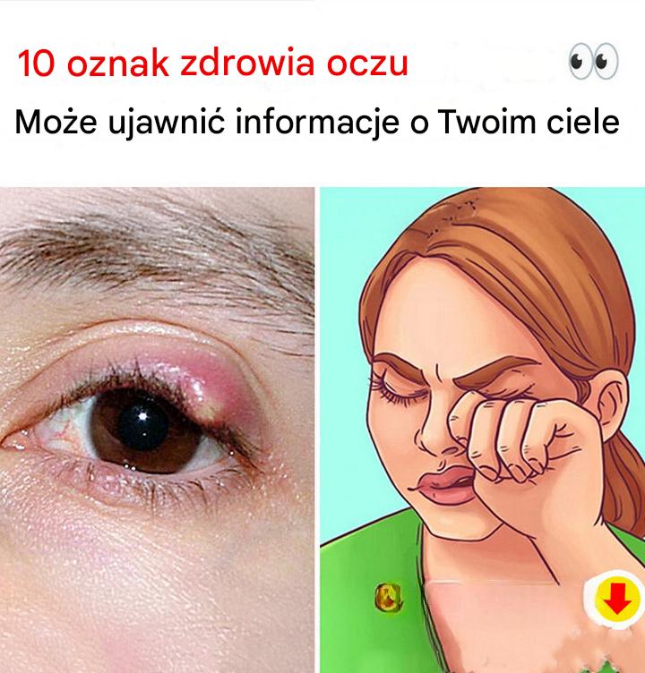10 oznak zdrowia, które Twoje oczy mogą ujawniać na temat Twojego ciała!