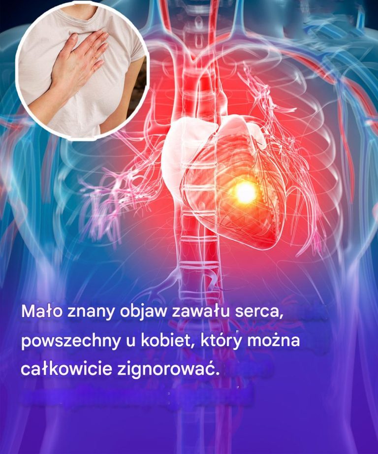 Mało znany objaw zawału mięśnia sercowego, powszechny u kobiet, który można całkowicie zignorować.