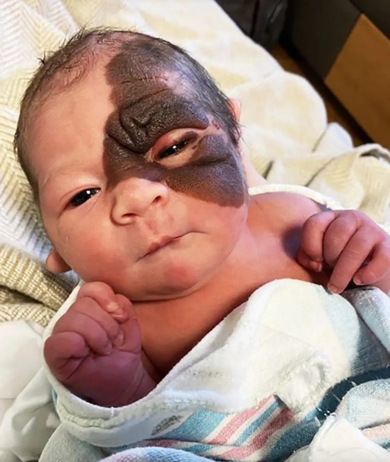 Rodzice byli zdumieni, widząc swoją córkę tuż po narodzinach: tak wygląda dzisiaj