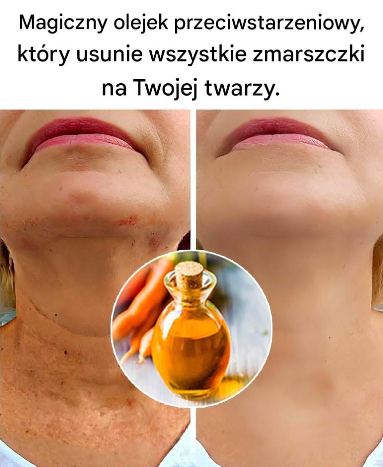 Magiczny olejek przeciwstarzeniowy, ☘️ Ten olejek usunie wszystkie zmarszczki na Twojej twarzy