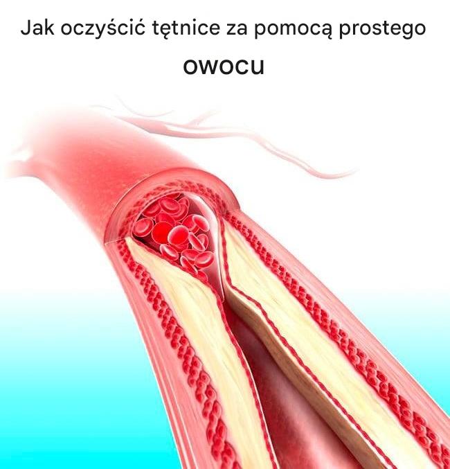 Jak oczyścić tętnice za pomocą prostego owocu