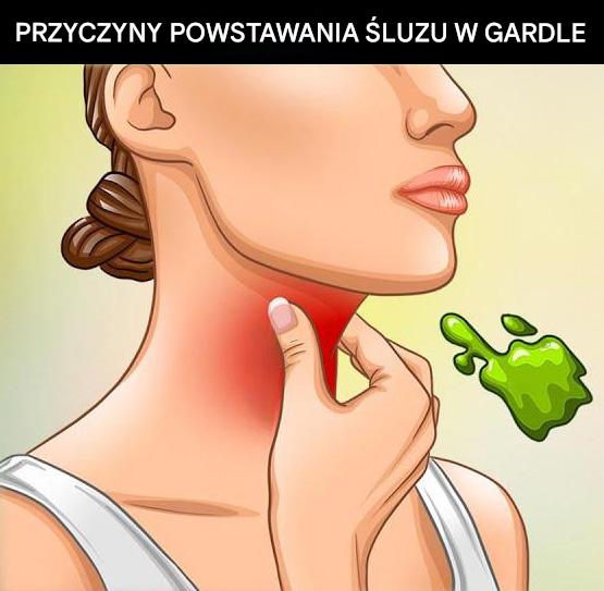 Prawdziwe przyczyny ciągłego zalegania flegmy i śluzu w gardle i jak się tego pozbyć