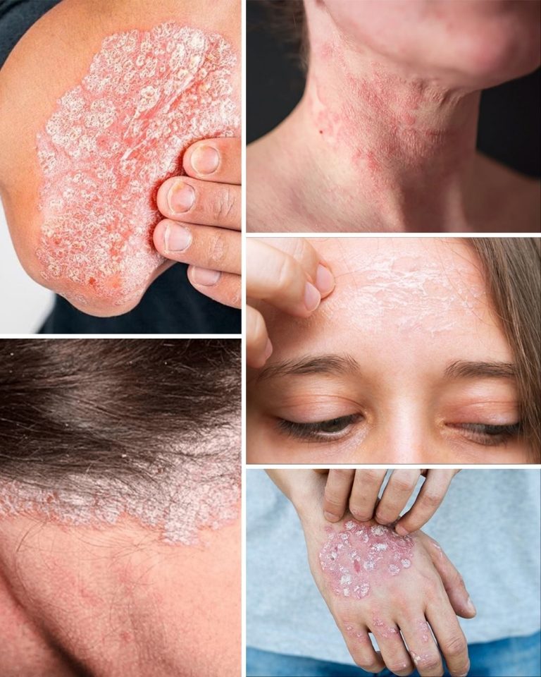 Znaki, które powinieneś znać, jeśli masz tę rzecz zwaną…