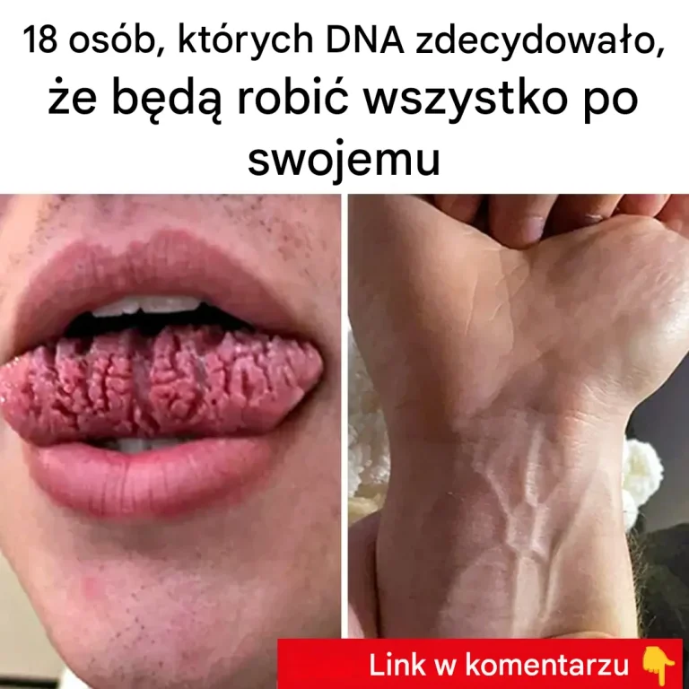 18 osób, których genetyka obrała inną ścieżkę