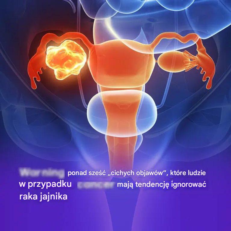 Sześć cichych objawów raka jajnika, które większość ludzi ignoruje