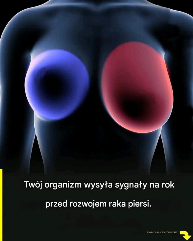 Rak piersi: 4 wczesne objawy, które powinna znać każda kobieta