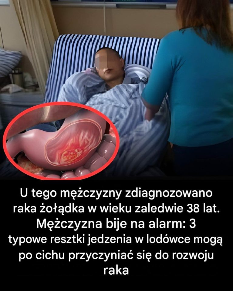 👇👇Żywność, której należy unikać, aby zapobiec rakowi żołądka: poruszająca historia trzydziestoletniego mężczyzny