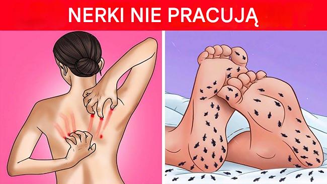 8 dziwnych oznak, że Twoje nerki wołają o pomoc