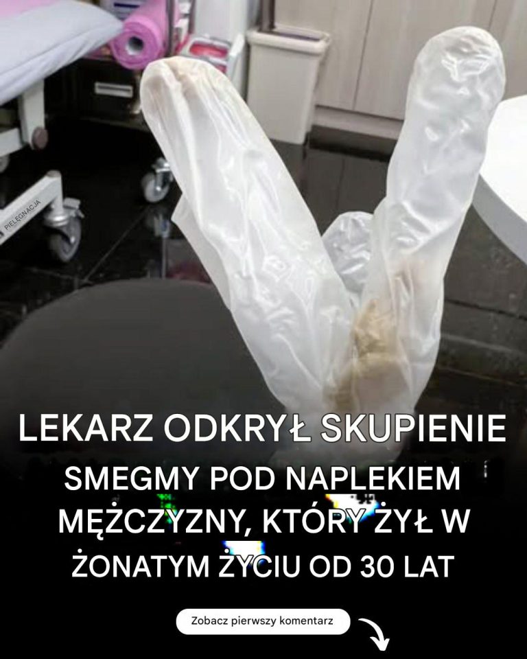 Lekarz odkrył 30-letni nagromadzenie smegmy pod napletkiem żonatego mężczyzny, który cierpiał na potworny ból.